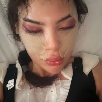 Dr. Alper Tuncel Estetik Operasyon Sonrası Yaşadığım Süreç Ve Yeniden Ücret Talebi