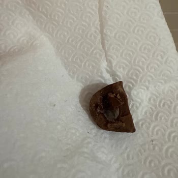 Küflü Çikolata, Tartım Hatası Ve Müşteri Şikayetine Cevap Verilmemesi