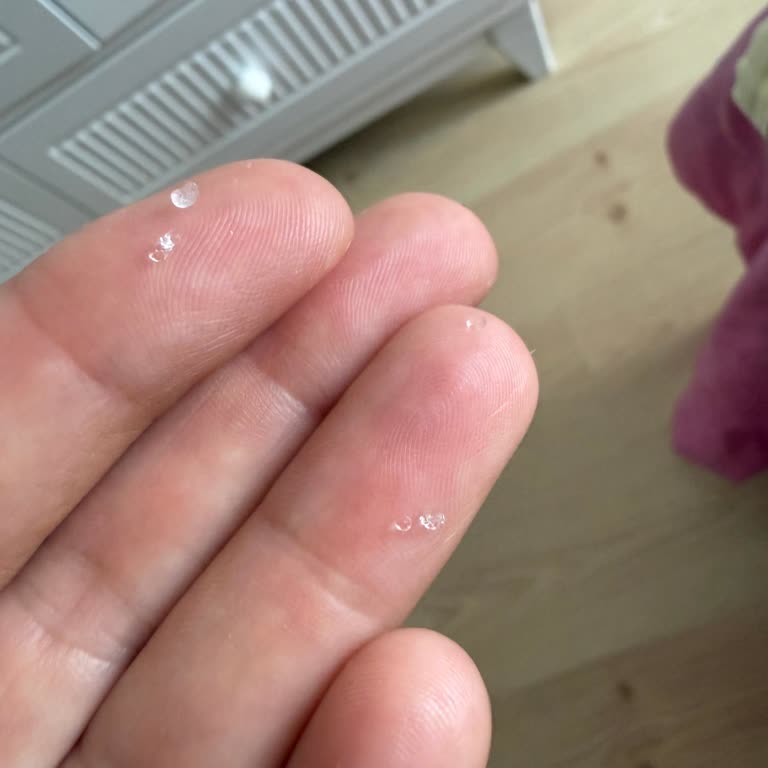 Kotex Hijyenik Pedde Silikon Parçaları, Sağlık Riski Ve İnceleme Talebi