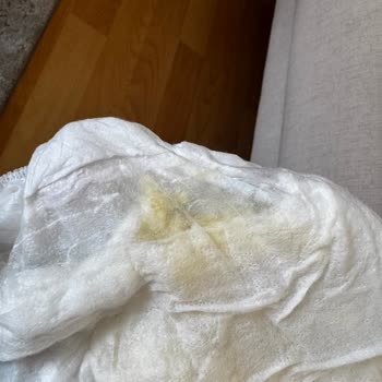 Molfix Bezinde Şeffaf Tanecikler Ve Şiddetli Pişik