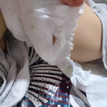 Sleepy Bebek Bezlerinde Geniş Üretim Hatası Ve Kargo Sürecindeki Problemler