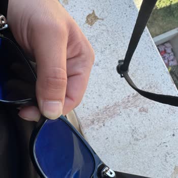 Rayban Gözlüğündeki Cam Kararması Ve Çerçeve Çizikleri İçin Garanti Kapsamında Ücretsiz Değişim