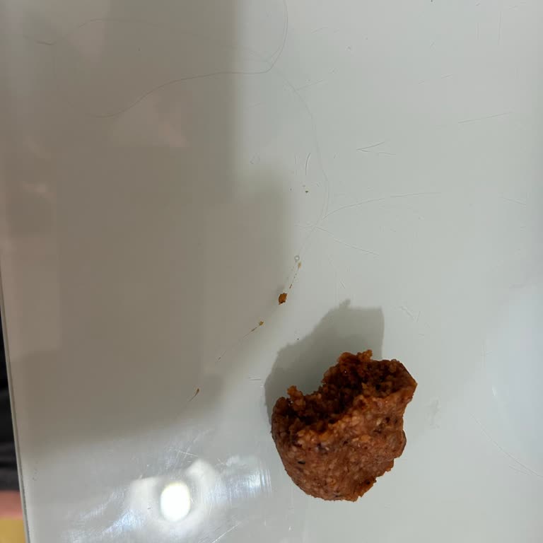 Çiğ Köfte İçinde Kıl Bulunması Ve Hijyen Sorunu