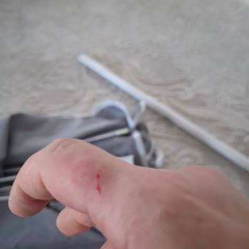 Kırık Ve Paslı Şemsiye, Fiziksel Zarar Ve 265 TL Kargo İadesi Talebi