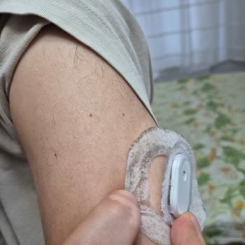 Sibionics GS1 Sensöründe Koruyucu Bant Kopması Ve Yeni Sensör Talebi
