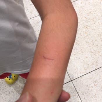 Guess Mağazasında Serbest Dolaşan Kedi Çocuğumu Tırmaladı Ve Tatilimi Mahvetti