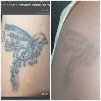 Opia Beauty'de Çekiliş Sözü İhlali Ve Başarısız Güzellik Hizmetleri Nedeniyle Sağlık Sorunları