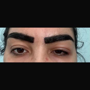 Opia Beauty'de Çekiliş Sözü İhlali Ve Başarısız Güzellik Hizmetleri Nedeniyle Sağlık Sorunları