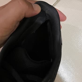 Adidas Duramo Ayakkabının 5 Ayda Yırtılması Ve Amazon’un İade Talebini Reddetmesi