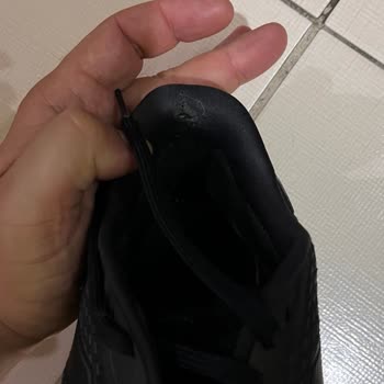 Adidas Duramo Ayakkabının 5 Ayda Yırtılması Ve Amazon’un İade Talebini Reddetmesi