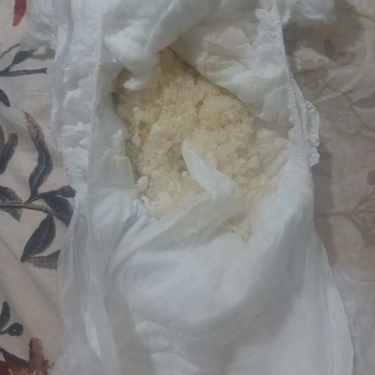 Molfix 6 Numara Bezlerde Beyaz Granüller Çıktı, Bebek Cildi Tahriş Oldu