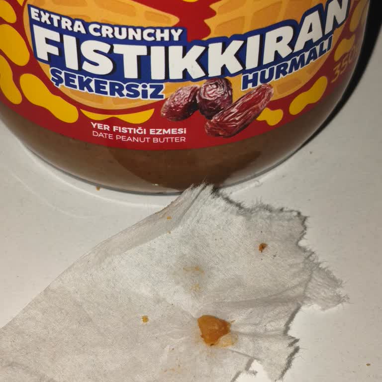 Yer Fıstığı Ezmesinde Taş Sertliğinde Yabancı Madde Dişine Zarar Verdi