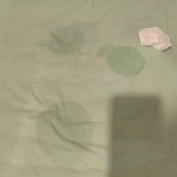 Pampers 1 Numaralı Bebek Bezinde Şiddetli Sızdırma Ve Cilt Yanması