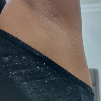 Kırılma Ve Beyaz Pullanma Sorunu Nedeniyle Nivea Stik Deodorantın Değişimini Talep Ediyorum