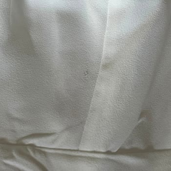 Defolu Abiye Ürünü İçin İade Reddi Ve Kupon Teklifi