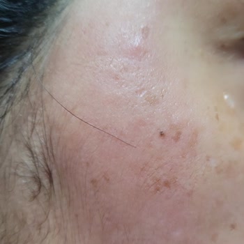 Sebamed Şampuanı Alerjik Reaksiyon Yaratırken Watsons İade Talebini Reddetti