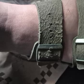 Boyner'den Birkenstock Arizona Terlikte Kısa Sürede Deri Soyulması Ve Değişim Talebi