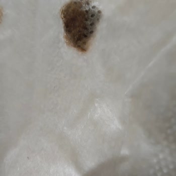 Molfix Bezlerinde Koyu Lekeler Prematüre Bebeği Endişelendirdi Ve Şirket Yanıtı Yetersiz