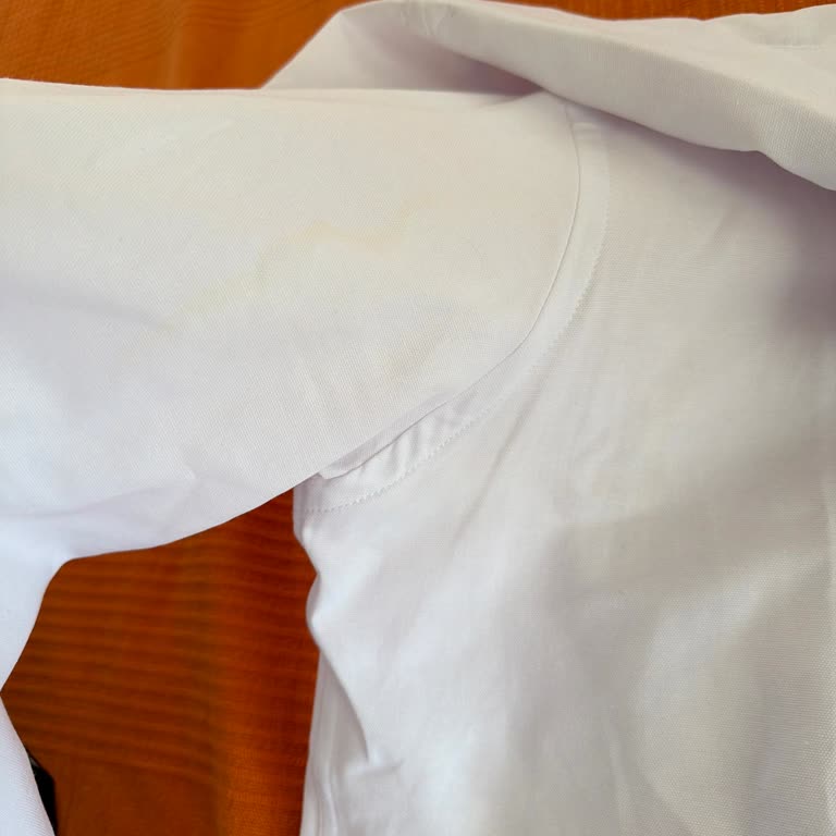 Boyner'den Gelen Kullanılmış, Lekeli Ve Deodorant Kokulu Gömlek İçin İade Talebi
