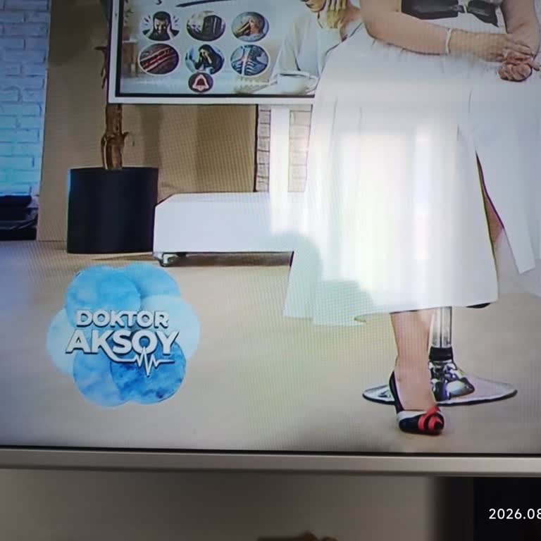 Garanti Kapsamındaki Ekran Gölgelemesi Ve Çözüm Yokluğu