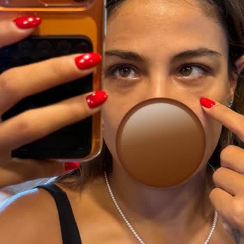 FDA Onayı Olmayan Göz Altı Enjeksiyonu Nedeniyle Mağduriyet Ve İade Talebi