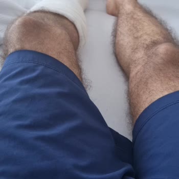 Arsi Hotels Asansörün Yere Çakılması Sonucu Ayak Bileğim Çatladı Sorumluluk Almıyor