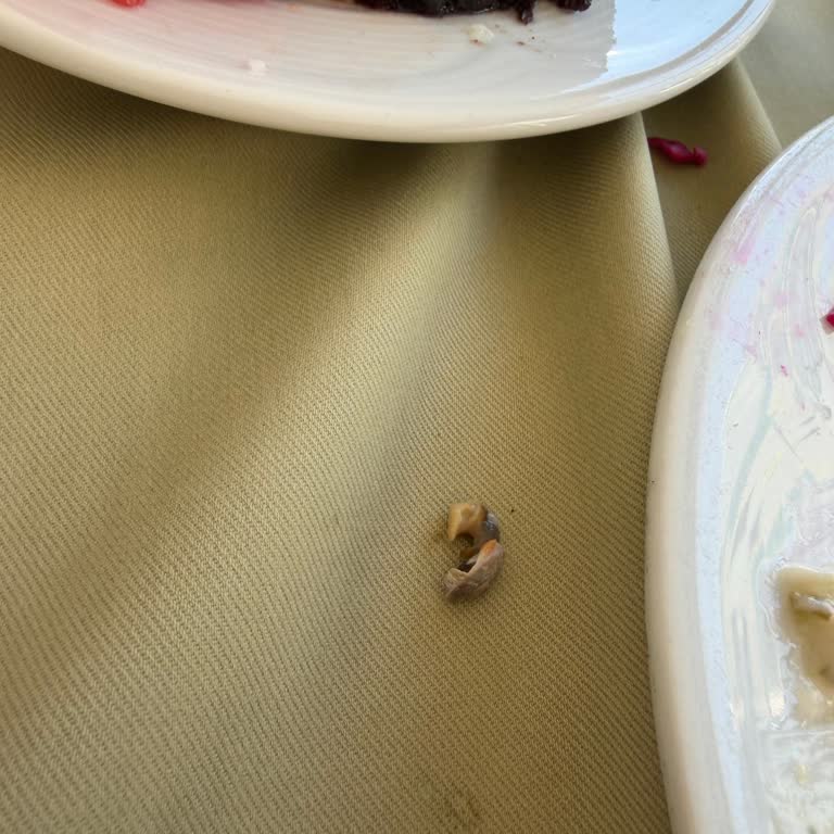 Antalya Otelinde Salataya Karışan Yabancı Cisim Dişimi Kırdı, Yetkililer Sorunu Görmezden Geldi