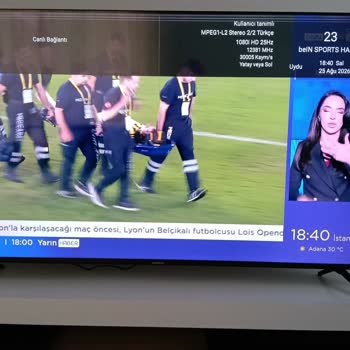 A101’den Alınan Televizyonun Kutu Hasarı, İç Çatlak Ve Kanal Kesintileri