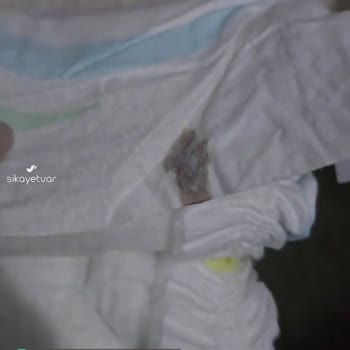Molfix Bebek Bezi İçinde Çıkan Madde