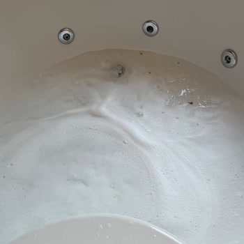 Ücret Ödedik Ama Hijyenik Olmayan Villa Ve Kirli Havuz Çocuğumu Hastalığa Sürükledi