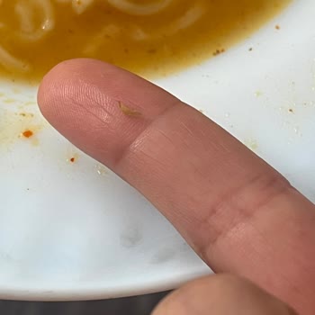 İndomie Noodle’da Tırnak Parçası Bulunması Ve Hijyen İhlali