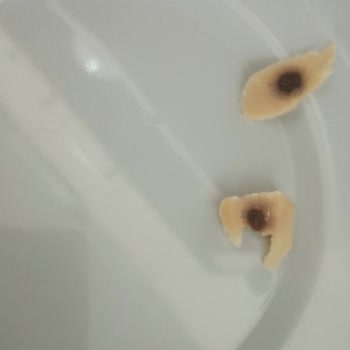 Keskinoğlu Sosisinde Kemik Parçası Ve Siyah Lekeler: Çocuk Sağlığı Riski