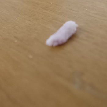 Keskinoğlu Sosisinde Kemik Parçası Ve Siyah Lekeler: Çocuk Sağlığı Riski