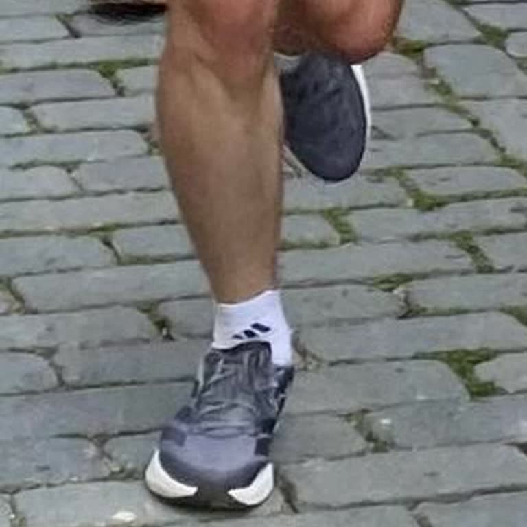 Adidas Duramo Speed 2 M Grey Ayakkabısının Tabanı İçeri Patladı Ve Yaralanma Sonucu İade Talebi
