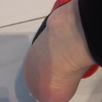 Ayak Yarasına Neden Olan Kadın Spor Ayakkabısı İçin Değişim Ve İade Talebi