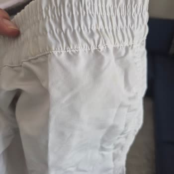 Rossmann Güneş Kremi Cilt Yanığı Ve Kalıcı Leke Sorunu Yaşattı, Müşteri Hizmetleri Cevap Vermedi