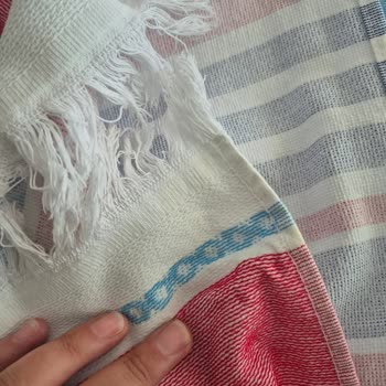 Rossmann Güneş Kremi Cilt Yanığı Ve Kalıcı Leke Sorunu Yaşattı, Müşteri Hizmetleri Cevap Vermedi