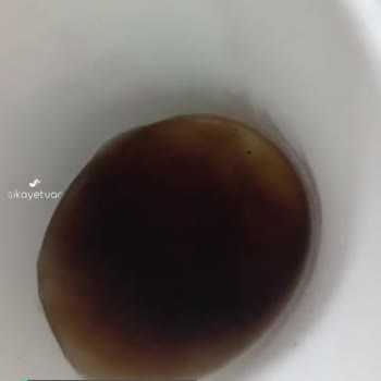Burger King Kolasından Çıkan Yabancı Madde Ve Bulanık Görüntü Skandalı