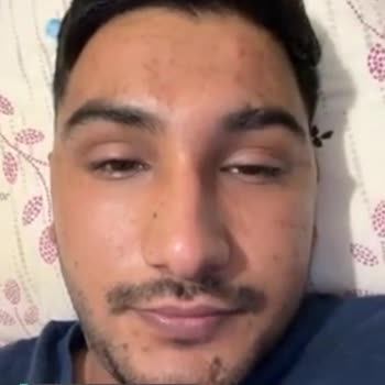 Ome Tv Kameramın Açılmasını İstiyorum!