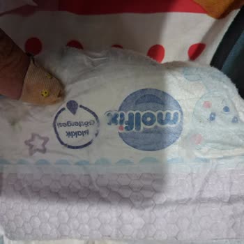 Molfix 4 Numaralı Bebek Bezlerinde Şiddetli Pişik Ve Hijyen Sorunu