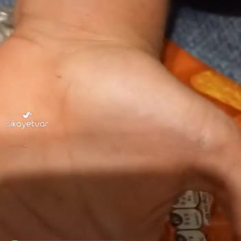 Doritos Cipsin İçinden Kıl Çıktı!