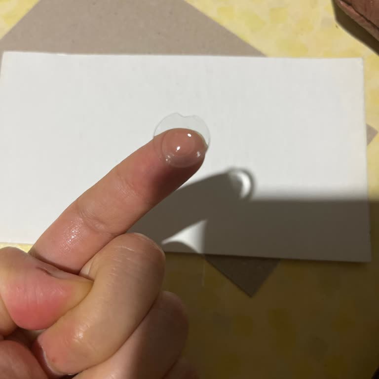 Çentikli Lensler Gözlerimde Kızarıklığa Neden Oldu, Satıcıdan Yanıt Gelmedi
