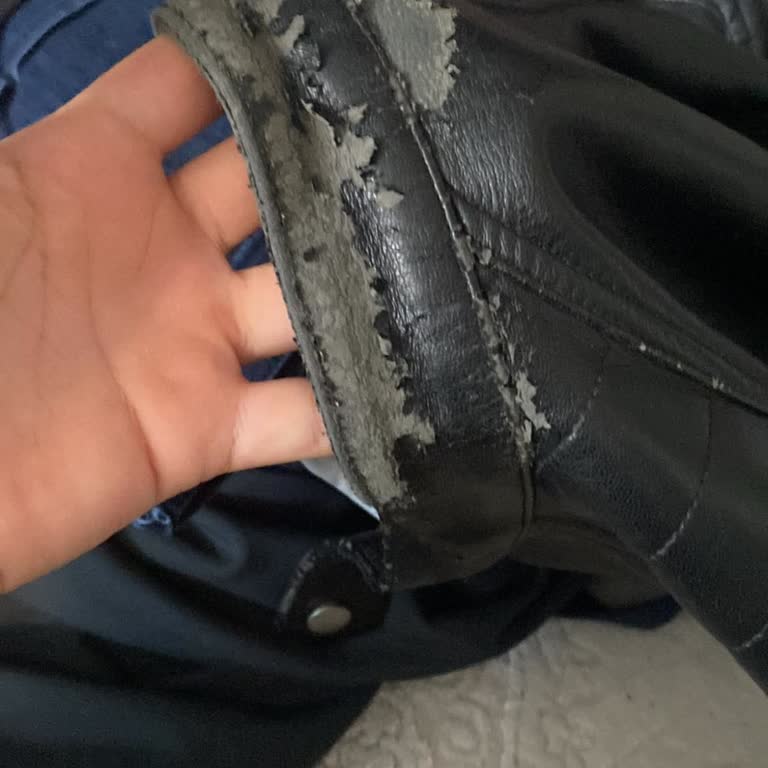 Üç Ayda Deri Cekette Dökmeler Ve Fiş Olmadan İade Reddi