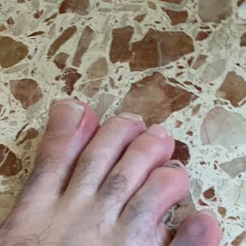 Ayaklarımı Boyayan Terlik İçin Ceyonun İade Reddi Ve Oyalama Taktikleri