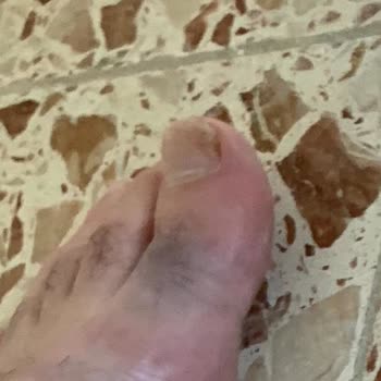 Ayaklarımı Boyayan Terlik İçin Ceyonun İade Reddi Ve Oyalama Taktikleri