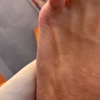 Terlikte Su Toplanması Ve Değişim Talebinin Reddedilmesi