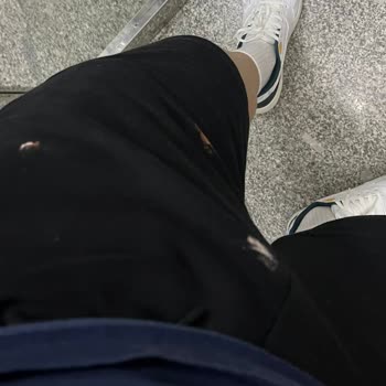Kusurlu Çamaşır Suyu Nedeniyle Kıyafet Zararım Ve Yetersiz Müşteri Hizmetleri
