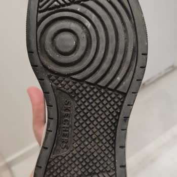 Skechers Ayakkabımda Erime Su Alma Ve Deri Soyulması Sorunu