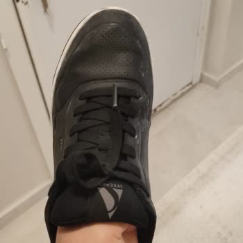 Skechers Ayakkabımda Erime Su Alma Ve Deri Soyulması Sorunu
