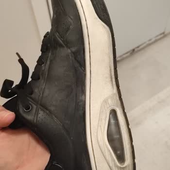 Skechers Ayakkabımda Erime Su Alma Ve Deri Soyulması Sorunu